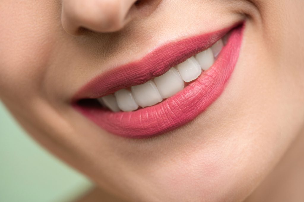 Close-up of a bright, healthy smile after cosmetic dentistry treatment